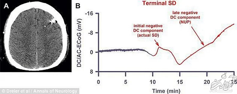زنده کردن مرده پس از مرگ
